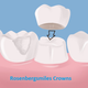 Illustration for article titled Selecting A Reputed Cosmetic Dentist | Rosenbergsmilesem/em